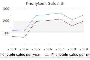 order 100mg phenytoin amex