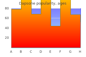 order cheap dapsone online